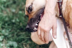 dog-bite-victim